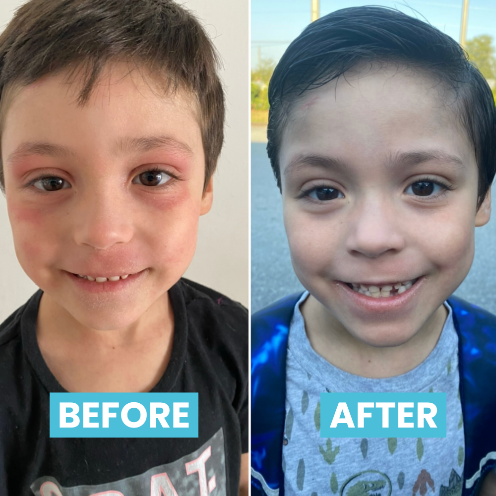 GlacierGlow balm
