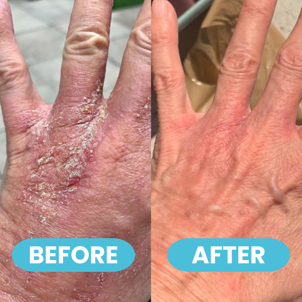 GlacierGlow balm