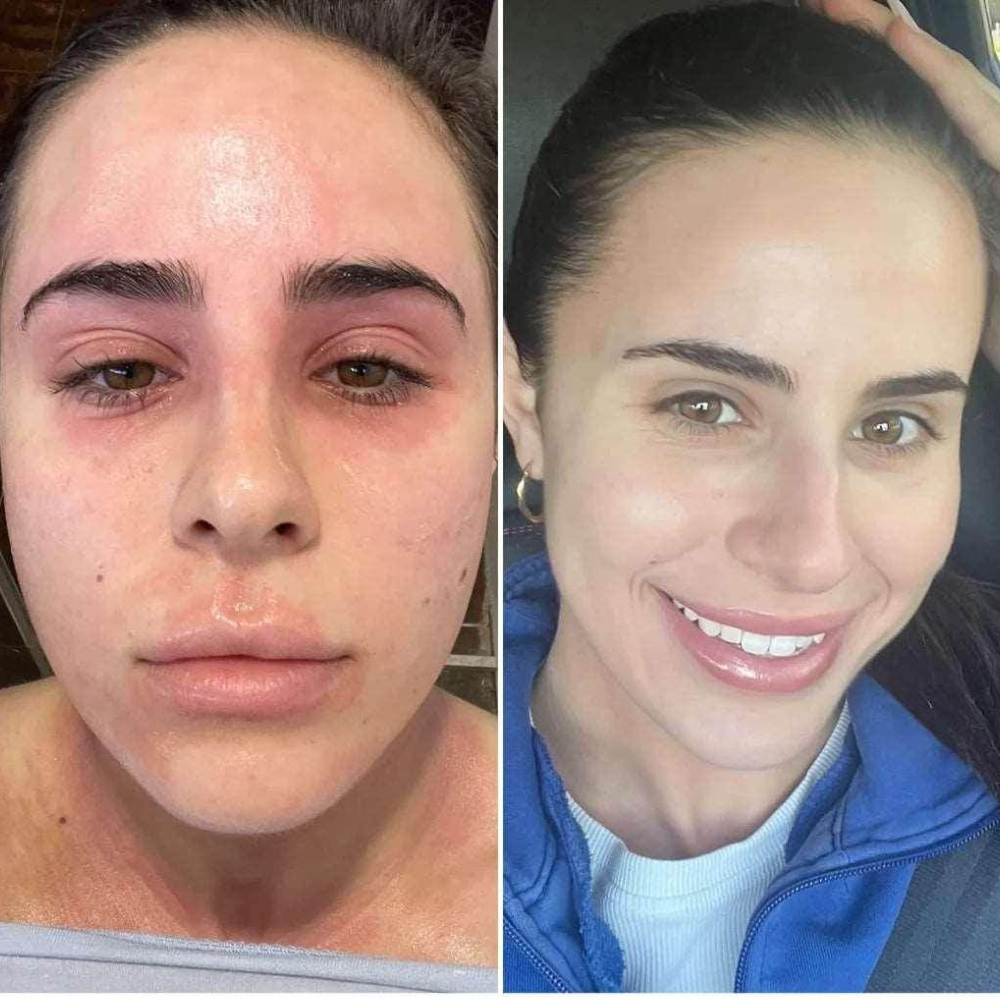 Customer photo