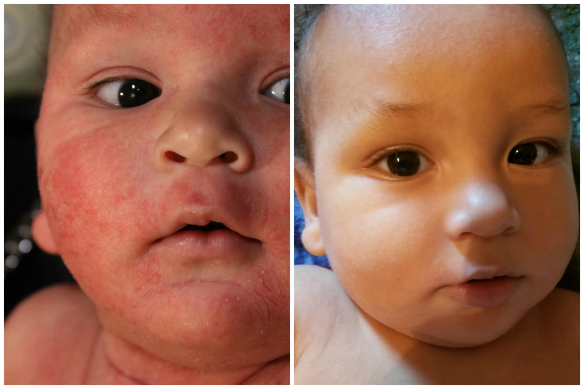 Before and after