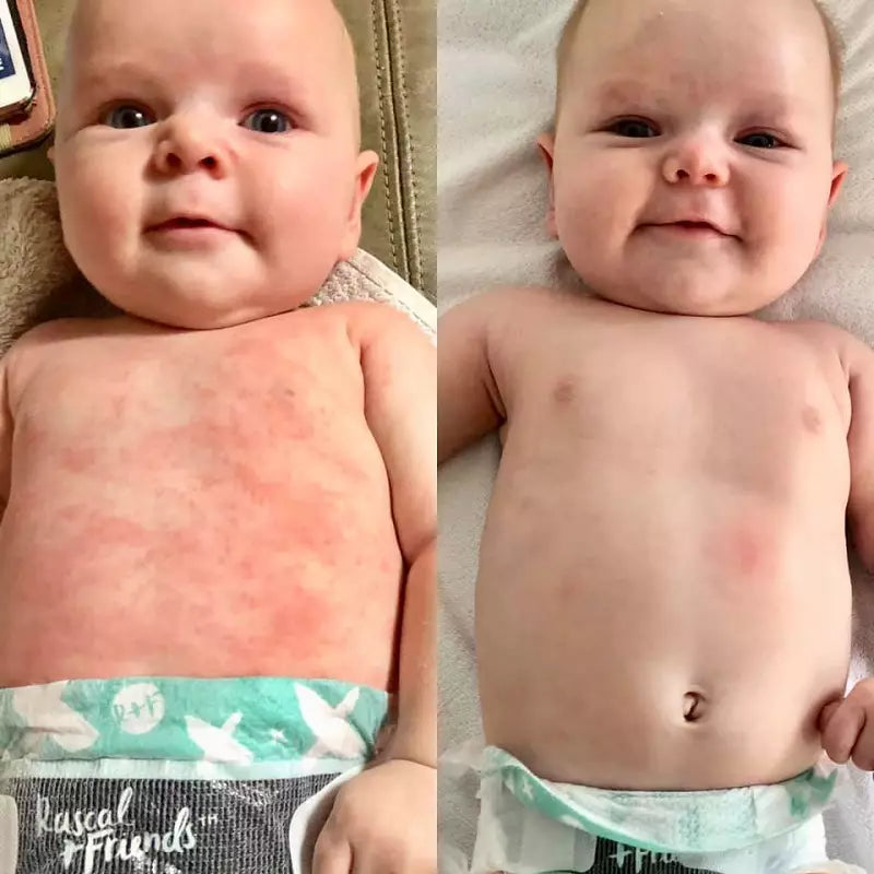 Before and after